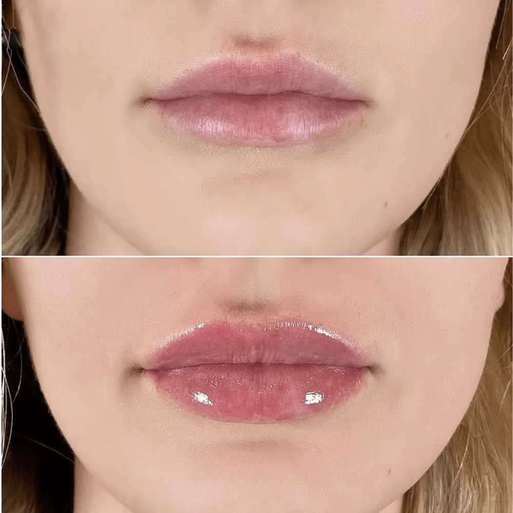 City Lips® Clear 👄