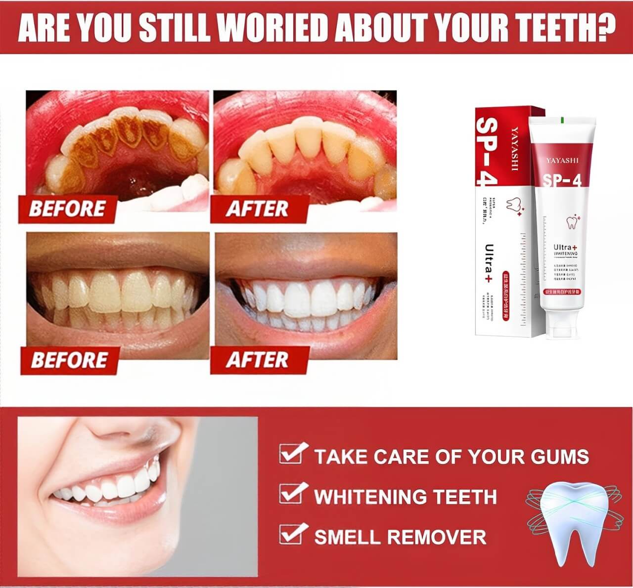 SP-4 Probiotic Toothpaste π