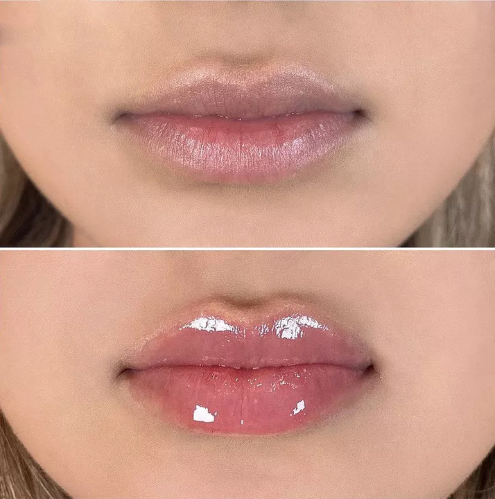 City Lips® Clear 👄
