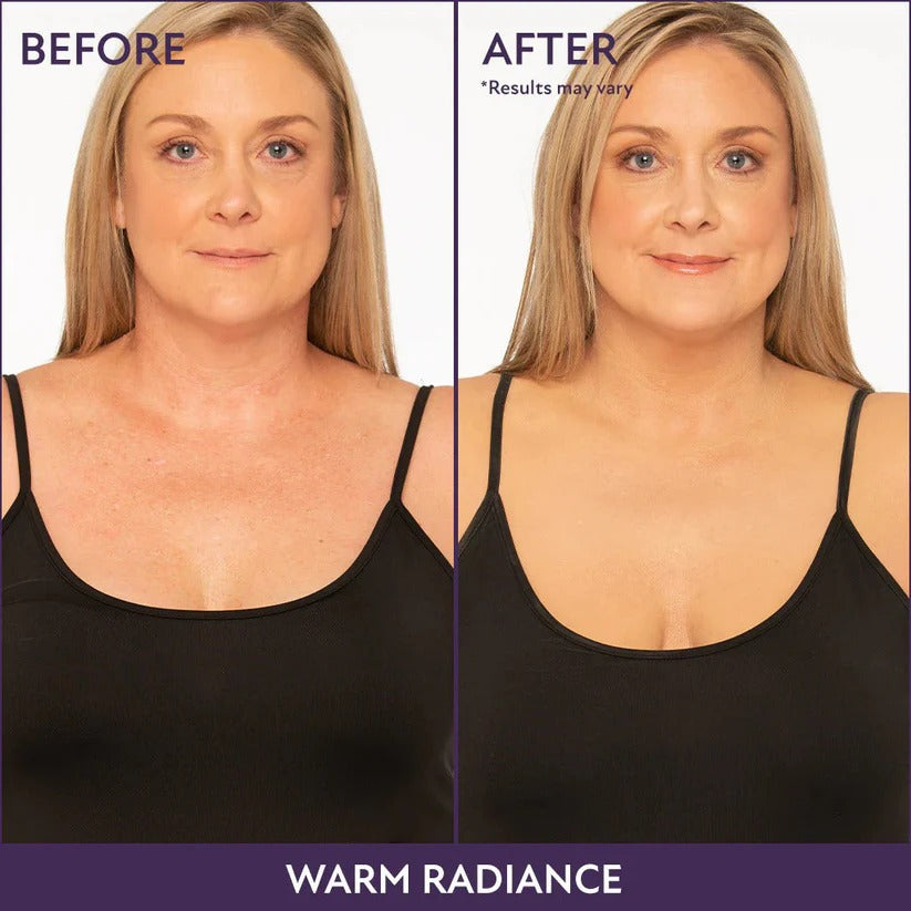 Body Coverage Profector