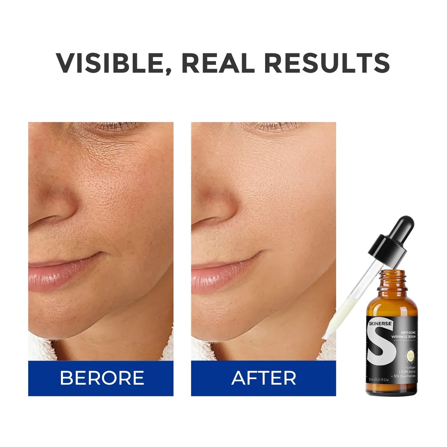SKINERSE™ Anti-Aging Wrinkle - Fine Lines Serum