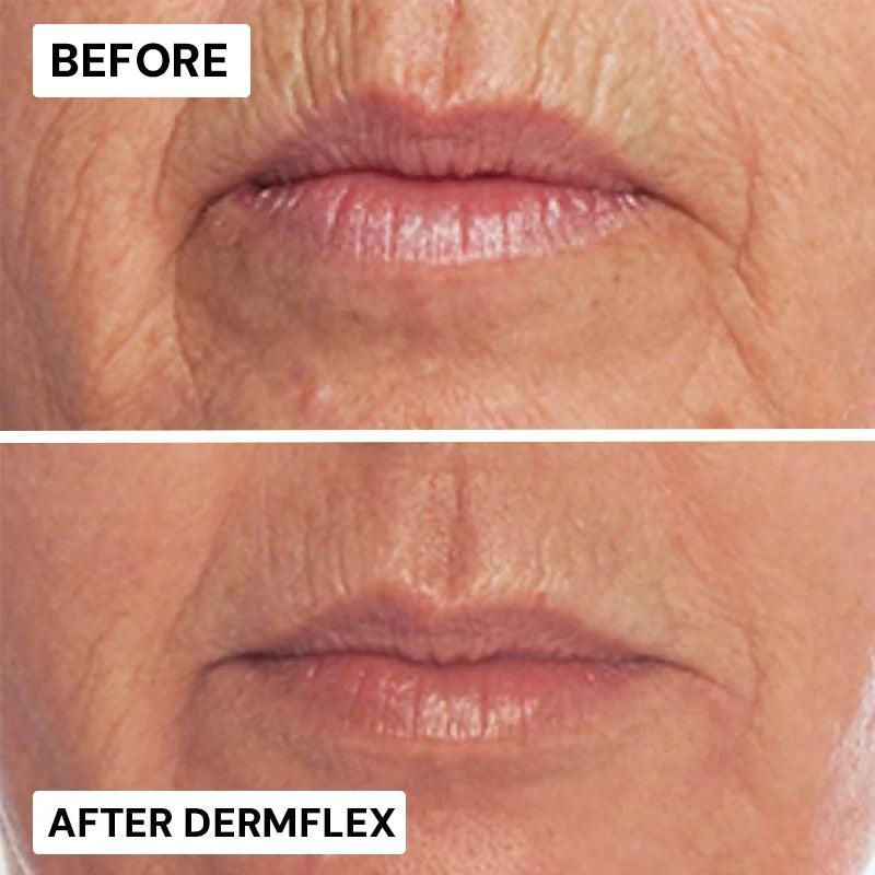 Dermflex™ Wrinkle-Eraser