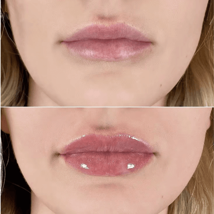 City Lips® Clear 👄