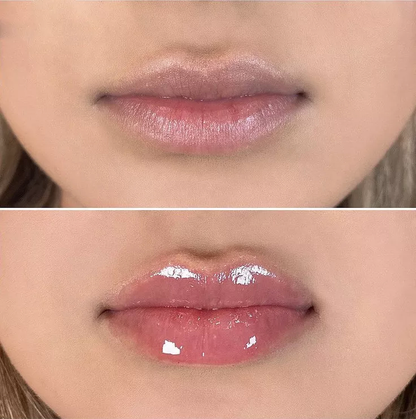 City Lips® Clear 👄
