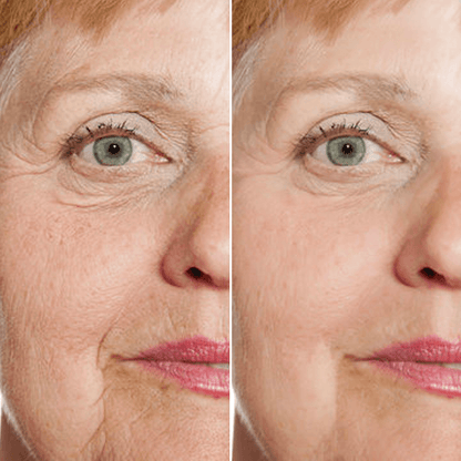 Rejuvenate Facial Serum