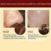 Masque facial peel-off affinant Pro-Herbal - 🔥ACHETEZ-EN 2, OBTENEZ-EN 1 GRATUIT🔥 