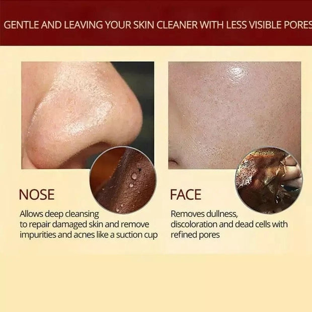 Pro-Herbal Refining Peel-Off Facial Mask- 🔥BUY 2 GET 1 Free🔥