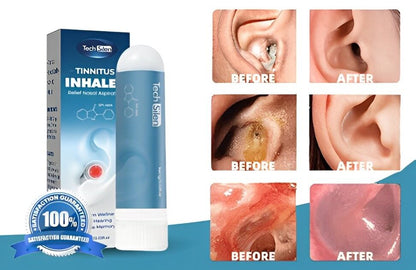 EarsCalm™ Nasal Relief 🌿
