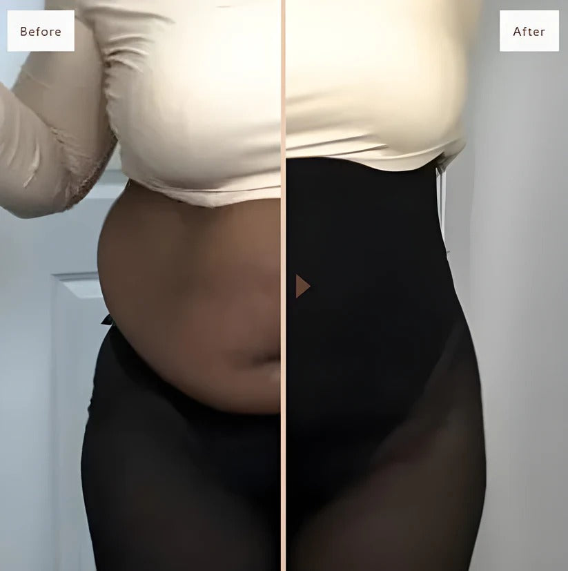 VeltroEase® Hight Waisted Shapewear Shorts